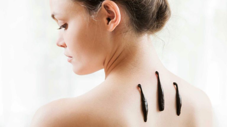 Blutegeltherapie Wann Tritt Wirkung Ein gesagesundheit.com
